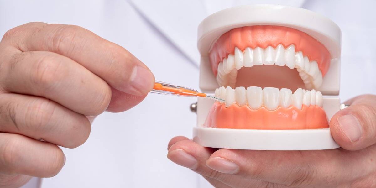 arcata dentale con tutti i nomi dei denti