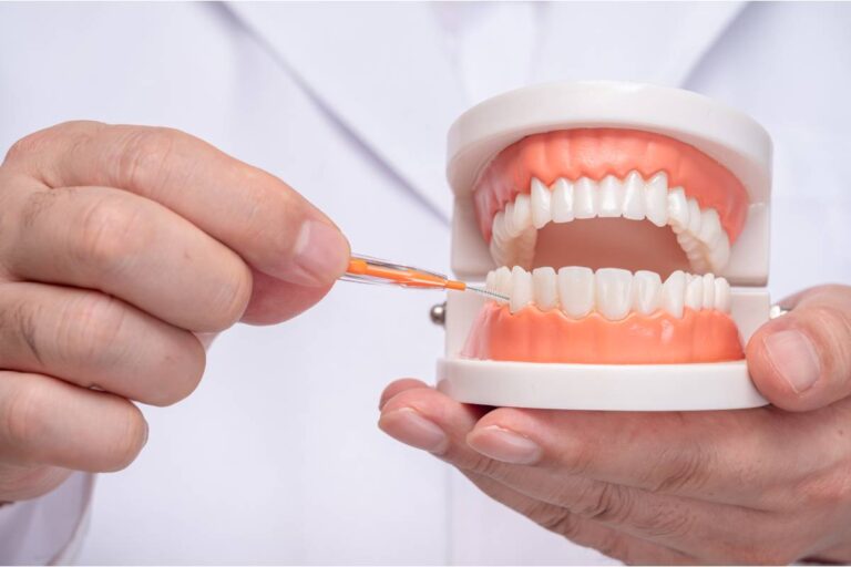 arcata dentale con tutti i nomi dei denti