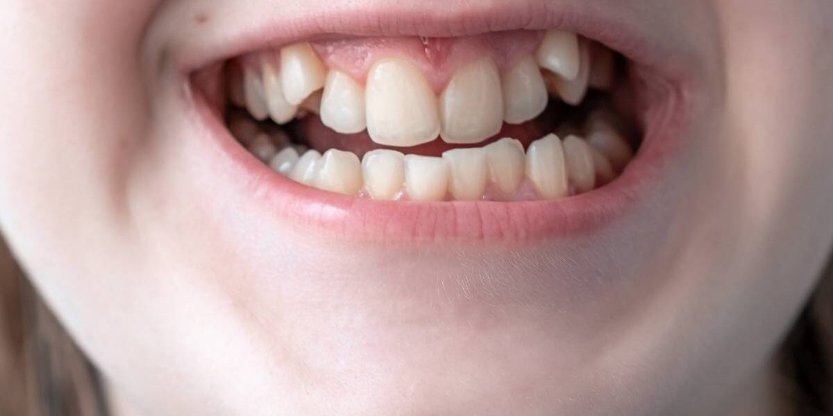 bambina si rivolge alla sua ortodontista per una malocclusione di seconda classe
