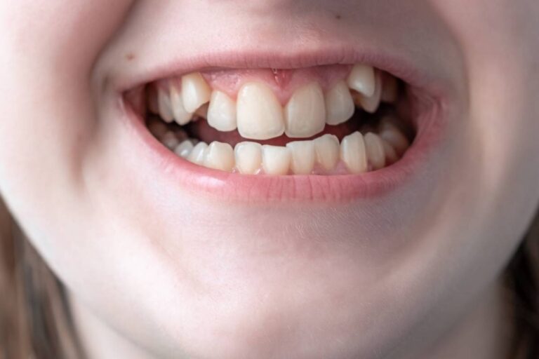bambina si rivolge alla sua ortodontista per una malocclusione di seconda classe